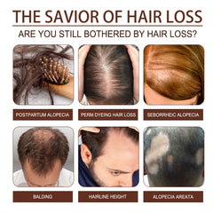 Castor Oil Hair Dense Essential Oil Repair Damaged Hair, Nourish Scalp, Strengthen Hair And Prevent Hair Loss