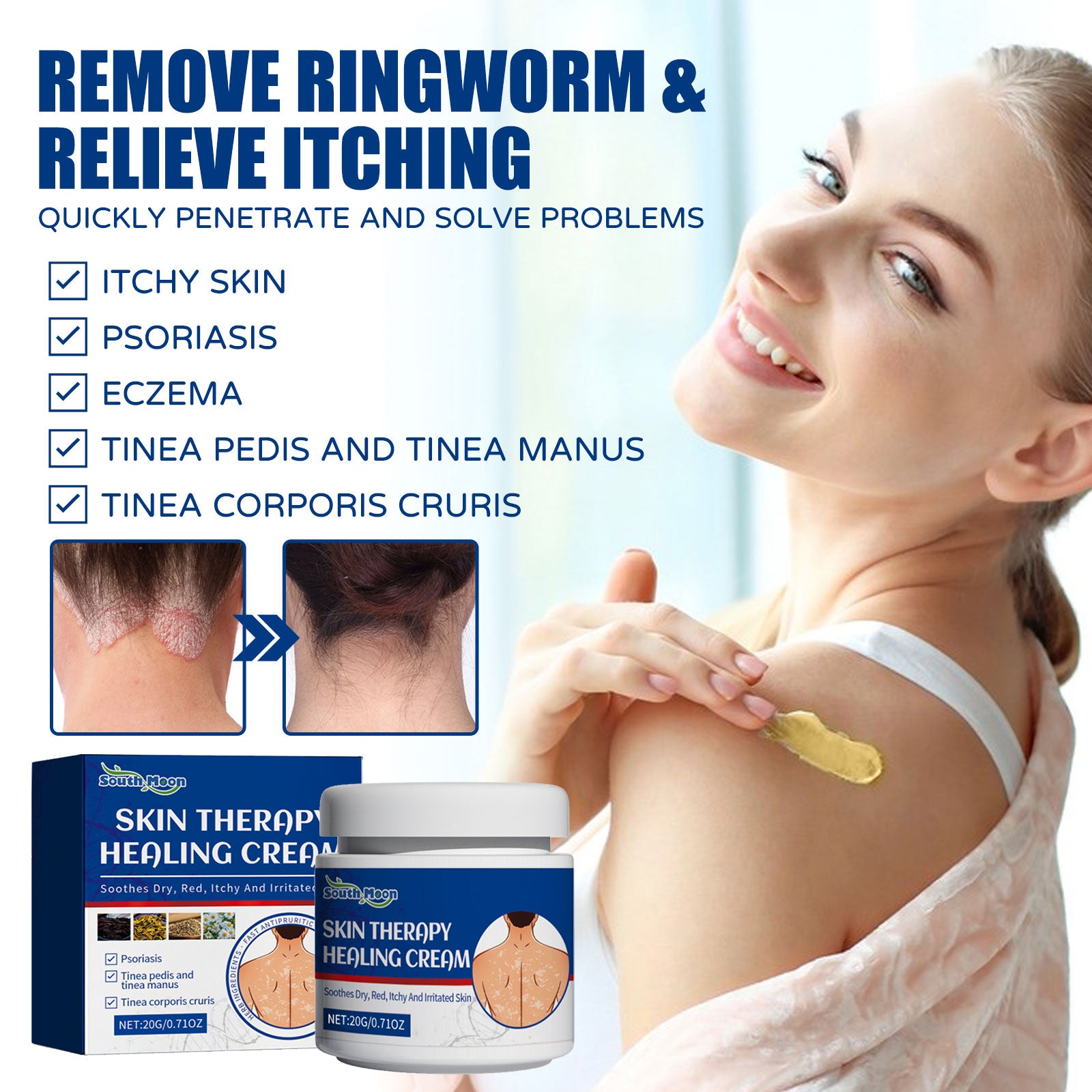 Skin Care Cream Gentle Ingredients Nourish Body Skin And Relieve Redness Skin Care Cream