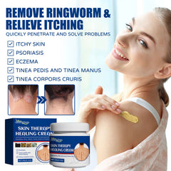 Skin Care Cream Gentle Ingredients Nourish Body Skin And Relieve Redness Skin Care Cream