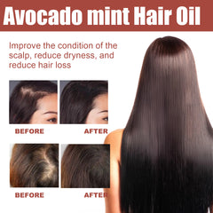 Hair Essential Oil For Dense Hair Care For Dry And Restless Hair Supple Hair Care Essential Oil For  Care